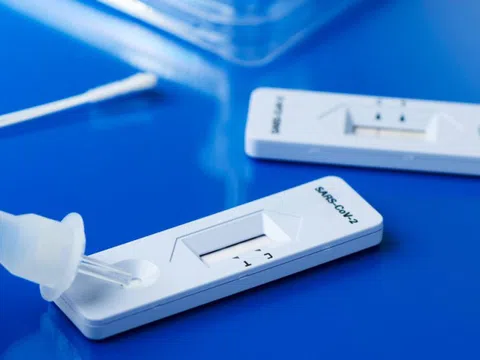 Cần làm gì để hạn chế “dương tính giả” khi test nhanh COVID-19?
