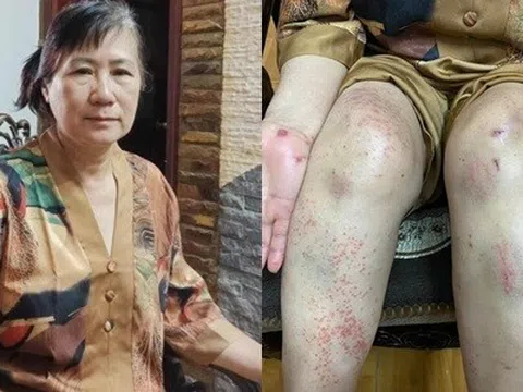Người phụ nữ sống sót sau 7 ngày rơi xuống vực: Không bịa chuyện để "câu like"
