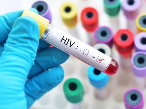 Phát hiện dương tính với HIV sau khi đi xăm hình