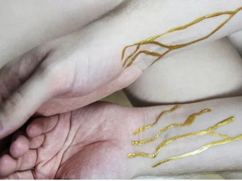 Trung Quốc phát hiện 2 phụ nữ có nhóm máu hiếm nhất thế giới, quý hơn vàng