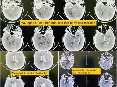 Người đàn ông bất ngờ đau đầu rồi gục xuống ghế khi đang làm việc tại cơ quan