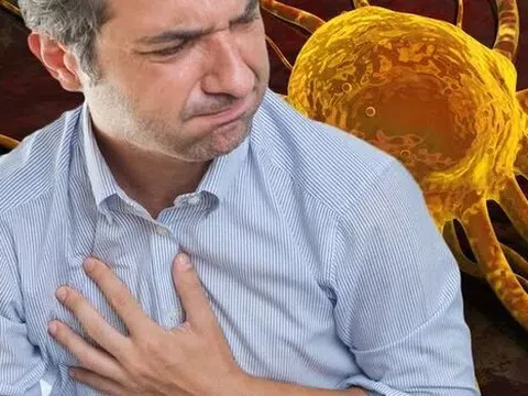 3 triệu chứng ở phần trên cơ thể liên quan đến ung thư giai đoạn 4