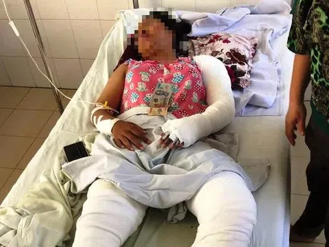 Mẹ kế tẩm xăng đốt sách vở của con chồng, khiến cả nhà bị bỏng nặng