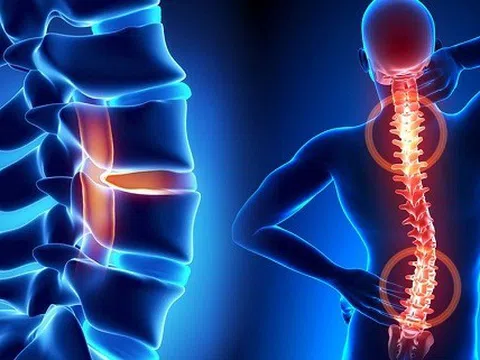 Củ dền tốt đến mấy, những người này cũng không nên ăn