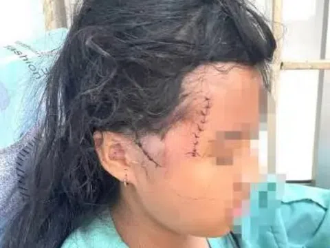 Đồng Nai: Bé gái 13 tuổi nghi bị cha dượng bạo hành