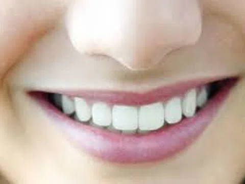 Bị mất răng cấm có trồng được không?
