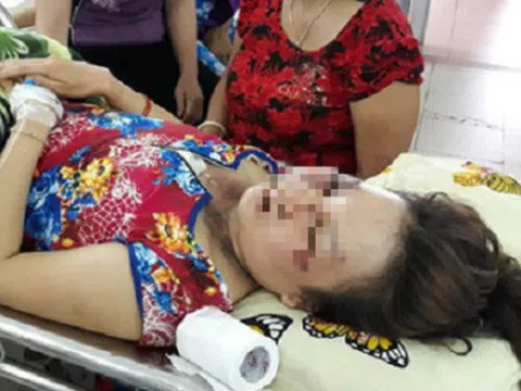 Bốn phụ nữ ở miền Tây bị sét đánh, chảy sợi dây chuyền vàng trên cổ