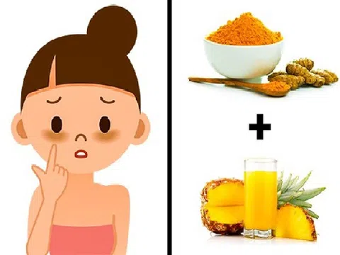 8 loại mặt nạ cực dễ tìm giúp chị em sở hữu làn da láng mịn 