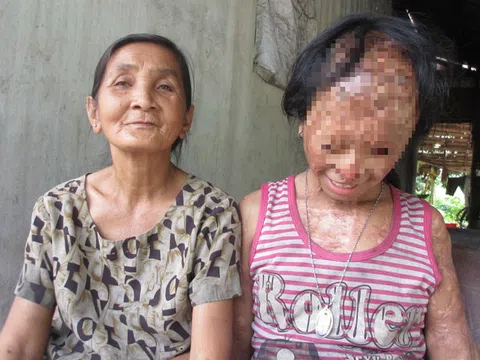 Bà nội của bé gái bị tạt axít đã đến tòa xin đôi mắt tử tù Nguyễn Hữu Tình