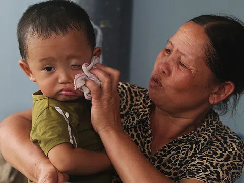 Người dân vùng ngập lụt Thủ đô Hà Nội mắc nhiều bệnh ngoài da