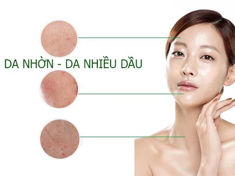 Công thức mặt nạ tự nhiên dành riêng cho da dầu