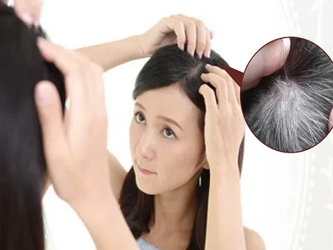 Mẹo nhỏ cho các chị em để ngăn ngừa tình trạng tóc bạc sớm