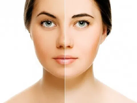 Học ngay 3 cách trị da mặt không đều màu sau một thời gian da sáng mịn trông thấy