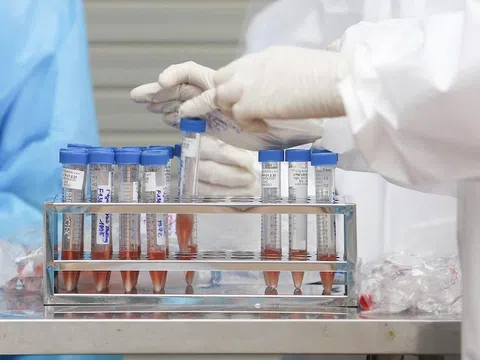 Hà Nội xét nghiệm sàng lọc SARS-CoV-2 cho hơn 26.000 nhân viên y tế