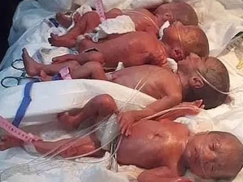 Bà mẹ trẻ 1 lần sinh 9 khiến các bác sĩ "tròn mắt"