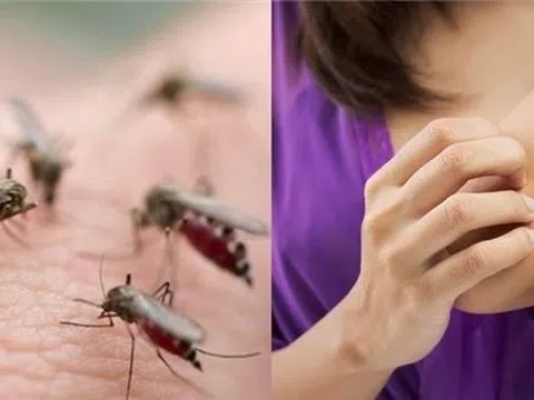 Lý do thú vị vì sao bạn thường xuyên bị muỗi đốt hơn người khác