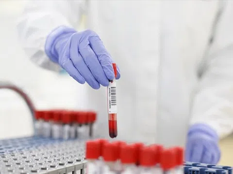 Người ra, vào TP.HCM phải xét nghiệm âm tính với SARS-CoV-2 trong vòng 3 ngày
