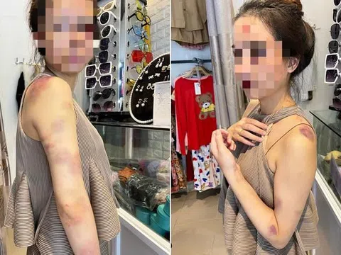Vụ người vợ bị chồng đánh đập dã man ở Yên Bái: Hội LHPN tỉnh đề nghị xử lý nghiêm