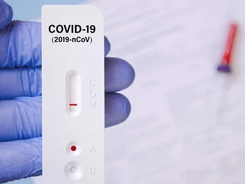 Vì sao nhiều người có triệu chứng nhưng test Covid-19 vẫn âm tính?