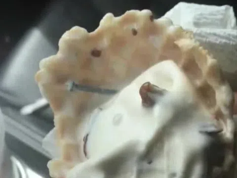 Nuốt phải đinh khi ăn kem, người mẹ 2 con được đền bù số tiền "khủng"