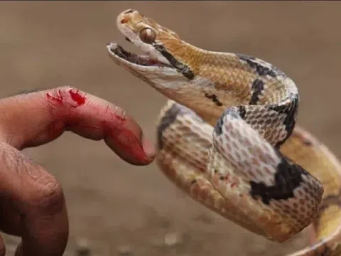 Cứu sống ngoạn mục bệnh nhân bị rắn hổ mang cắn trong tình trạng nguy kịch