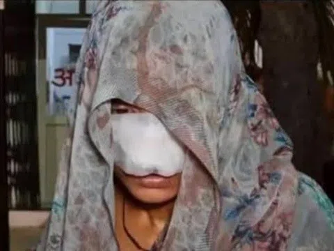 Rợn người cảnh chồng cắn mặt vợ như thời trung cổ vì mâu thuẫn gia đình, anh trai hé lộ tình tiết đau lòng