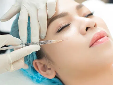 Tiêm filler: Cân nhắc cẩn thận và hiểu rõ trước mọi quyết định