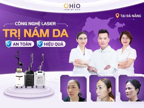 Điều trị nám da bằng Laser an toàn, hiệu quả tại Đà Nẵng