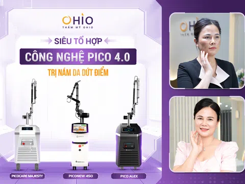 Trị nám da bằng tổ hợp công nghệ Pico tốt nhất tại Đà Nẵng