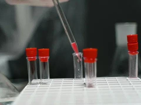 Nóng: Australia làm thất lạc 300 lọ virus, tất cả đều cực kỳ nguy hiểm với con người
