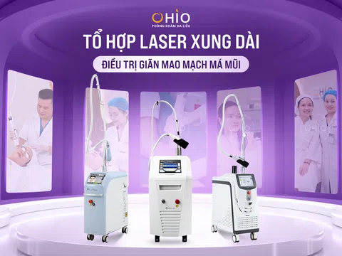 Trị giãn mao mạch vùng má, mũi với tổ hợp Công nghệ Laser xung dài