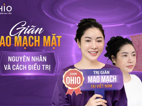 Giãn mao mạch mặt, nguyên nhân và cách điều trị