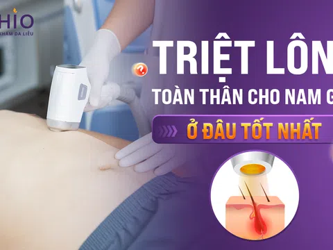 Triệt lông toàn thân cho nam giới ở đâu tốt nhất?