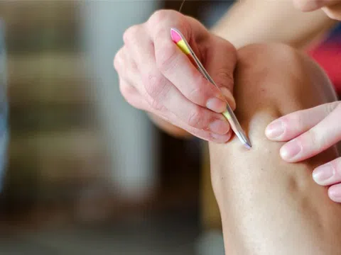 Nhổ lông mọc ngược, người đàn ông 39 tuổi nhập viện chỉ còn 4% cơ hội sống sót
