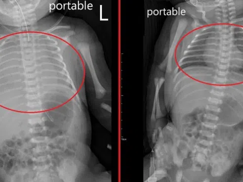 Bé sơ sinh chỉ khóc 2 tiếng rồi bất động: Người cha hoảng loạn, bác sĩ chỉ ra 'thủ phạm': Cha mẹ tuyệt đối không được bỏ qua