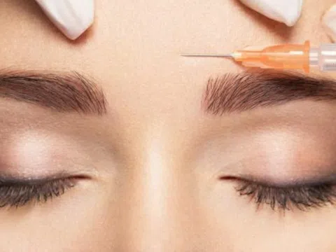 Trải nghiệm kinh hoàng của một phụ nữ sau khi tiêm botox