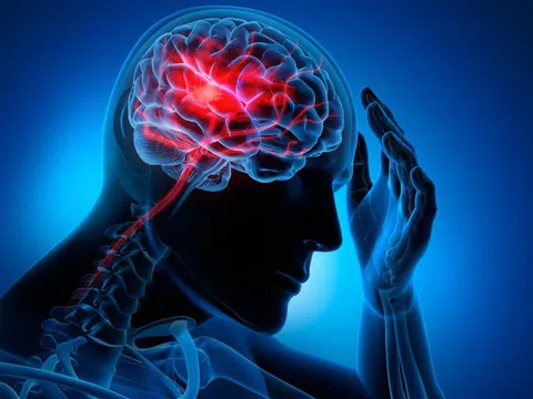 Vì sao đột quỵ não thường xảy ra buổi sáng?