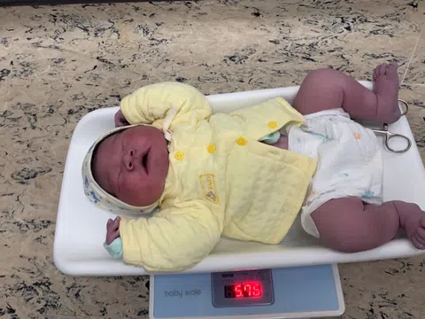 Hà Nội: Bé trai sơ sinh chào đời nặng 5,7 kg