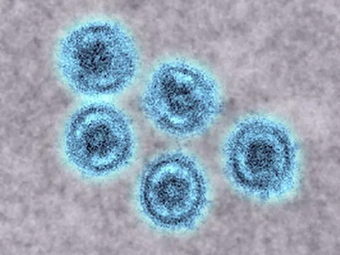 Lo ngại chủng virus Ebola có khả năng lây sang người