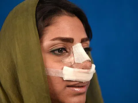 Iran ban hành lệnh cấm bác sĩ nam phẫu thuật thẩm mỹ cho nữ bệnh nhân