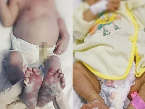 Mối nguy hiểm khi trẻ sơ sinh mắc 'bệnh người lớn'
