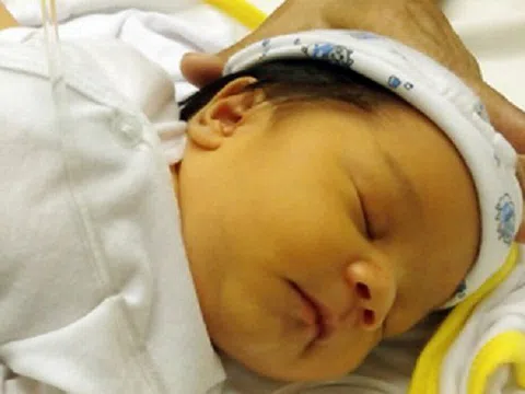 Tỷ lệ trẻ mắc vàng da sơ sinh tăng cao vào mùa lạnh, phụ huynh cần chú ý phòng tránh cho bé