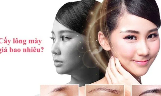 Cấy lông mày - phương pháp làm đẹp không đau phái đẹp yêu thích nhất