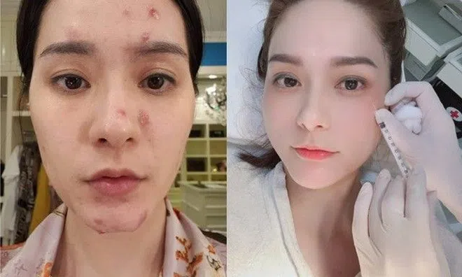 Ở nhà 400 tỷ, nữ đại gia Quận 7 cũng không chối từ bộ môn làm đẹp tiêm chích rẻ bèo