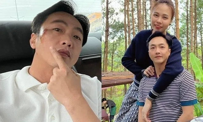 Cường Đô La đăng ảnh mặt bị thương, Đàm Thu Trang không thèm đoái hoài, dân mạng đoán "vợ đánh"