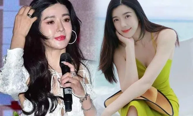 Chân dài đắt giá đẹp như tiên vẫn mê "dao kéo", giờ mặt sưng phù biến dạng, fans ruột nhận không ra