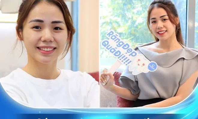 Thăng hạng nhan sắc chỉ trong 3 ngày, hàng loạt sao Việt tiết lộ bí quyết đơn giản nhưng không phải ai cũng biết!     