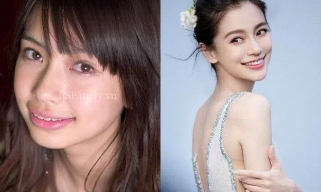 Bị đăng loạt ảnh thời “vịt xấu xí”, Angelababy bức xúc, có hành động ngay lập tức