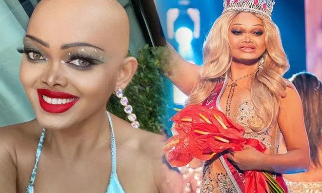 Hoa hậu trọc đầu lên ngôi, làm giới sắc đẹp tranh cãi dữ dội