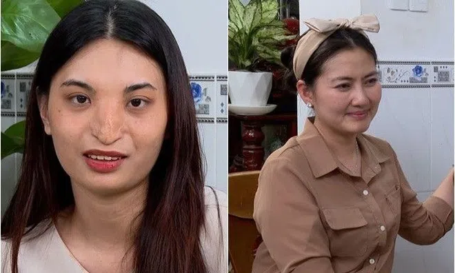 Nữ người mẫu "mũi không xương" làm Ngọc Lan xúc động, mẹ ruột chia sẻ khoảnh khắc đau lòng